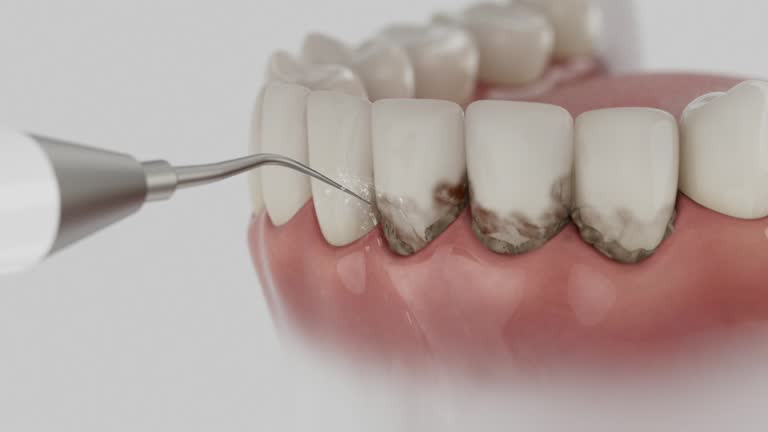 Reliable Tooth Extraction contractor in Charleston, AR by Smile Center Dentistry